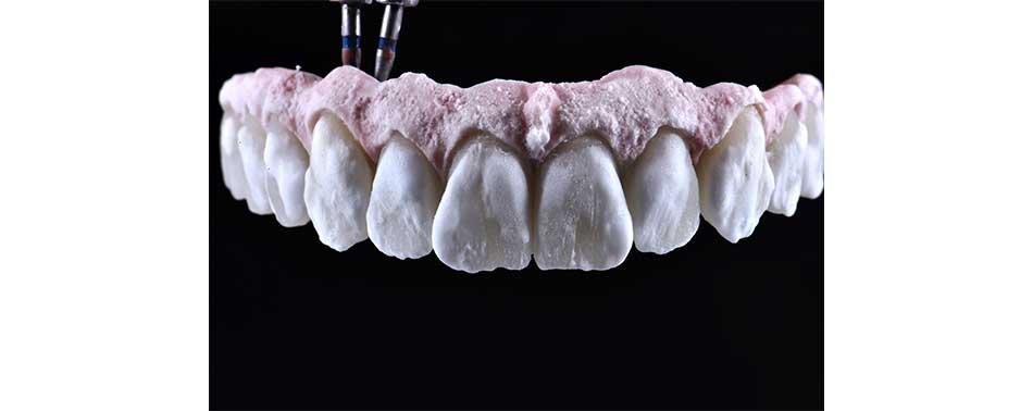 porcelana dental
