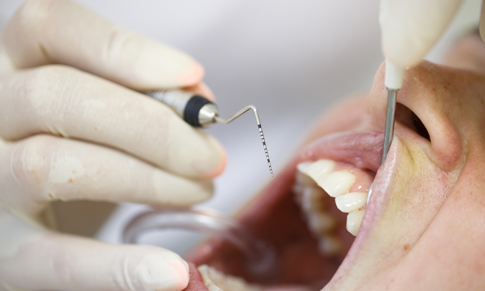 Doença periodontal e doenças cardiovasculares