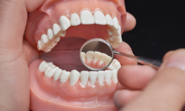 Descubra como ajustar e clarear uma prótese dental removível para um sorriso saudável e duradouro. Dicas essenciais dos nossos especialistas aqui.