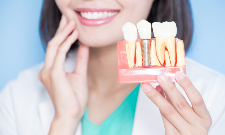 Implante dental: antes e depois