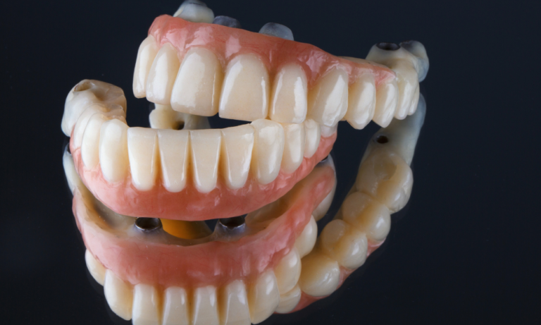 A melhor prótese dentária removível