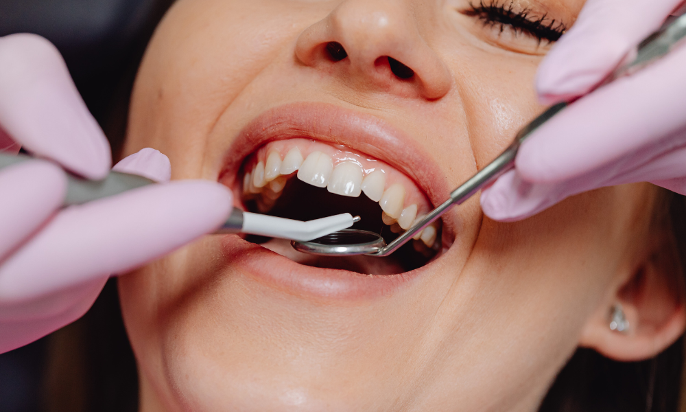 Descubra qual profissional faz gengivoplastia