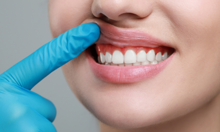 Descubra qual profissional faz gengivoplastia